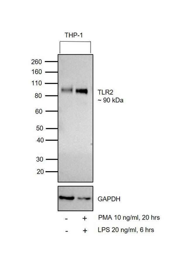 TLR2 Antibody in Western Blot (WB)