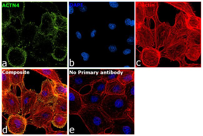 alpha Actinin 4 Antibody in Immunocytochemistry (ICC/IF)