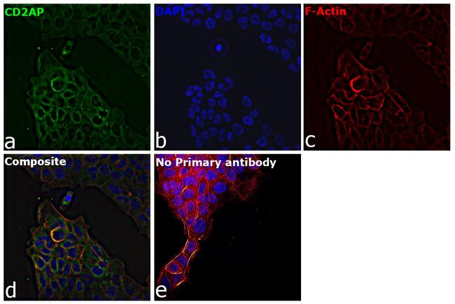 CD2AP Antibody in Immunocytochemistry (ICC/IF)