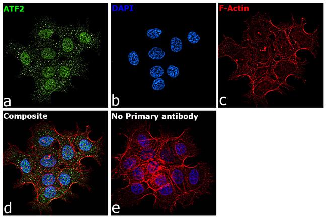 ATF2 Antibody in Immunocytochemistry (ICC/IF)