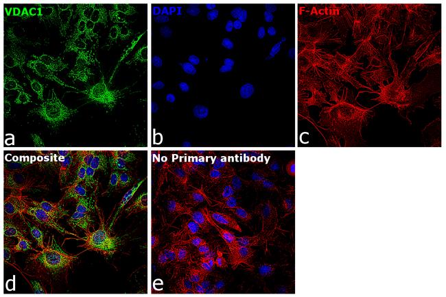 VDAC Antibody in Immunocytochemistry (ICC/IF)