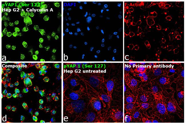 Phospho-YAP1 (Ser127) Antibody in Immunocytochemistry (ICC/IF)