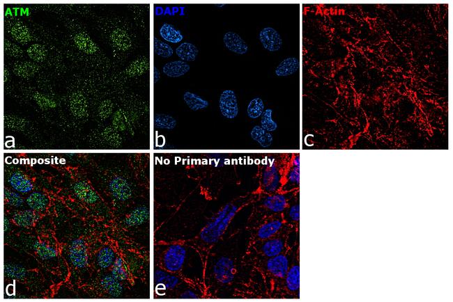 ATM Antibody in Immunocytochemistry (ICC/IF)