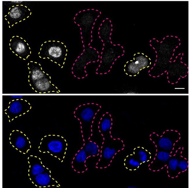 RXRA Antibody in Immunocytochemistry (ICC/IF)