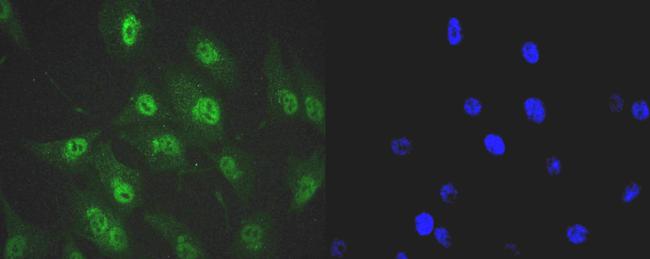 SRSF3 Antibody in Immunocytochemistry (ICC/IF)