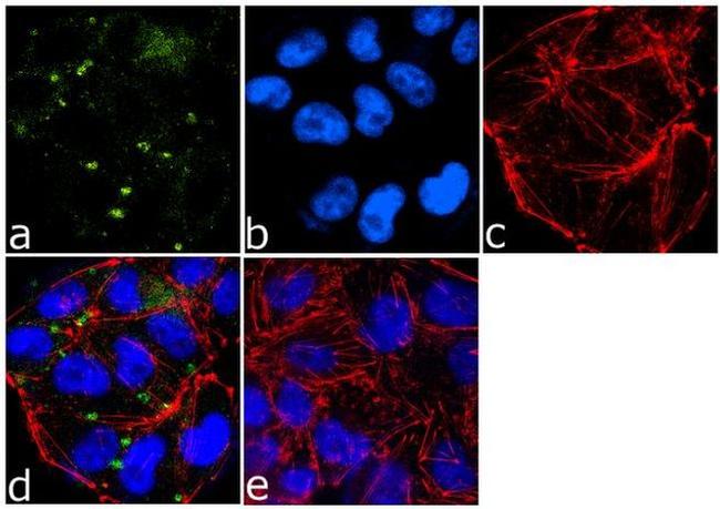 ICAM-1 Antibody in Immunocytochemistry (ICC/IF)