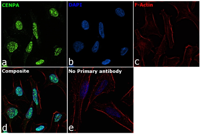 CENPA Antibody in Immunocytochemistry (ICC/IF)