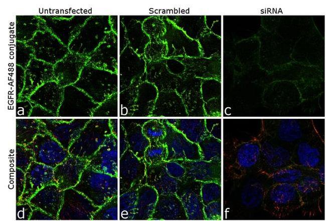 EGFR Antibody in Immunocytochemistry (ICC/IF)