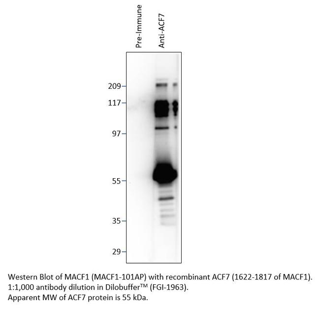 MACF1 Antibody in Western Blot (WB)