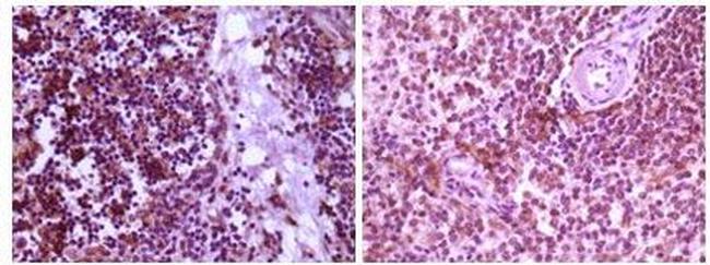 MAP2K4 Antibody in Immunohistochemistry (Paraffin) (IHC (P))