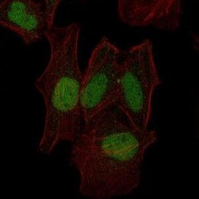 MEK7 Antibody in Immunocytochemistry (ICC/IF)