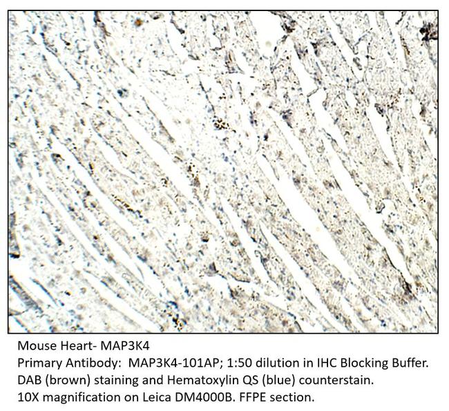 MAP3K4 Antibody in Immunohistochemistry (IHC)