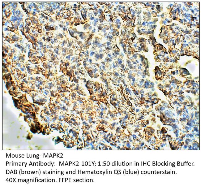 MAPK2 Antibody in Immunohistochemistry (IHC)