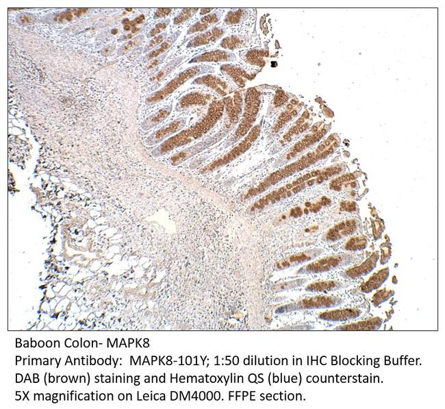 MAPK8 Antibody in Immunohistochemistry (IHC)