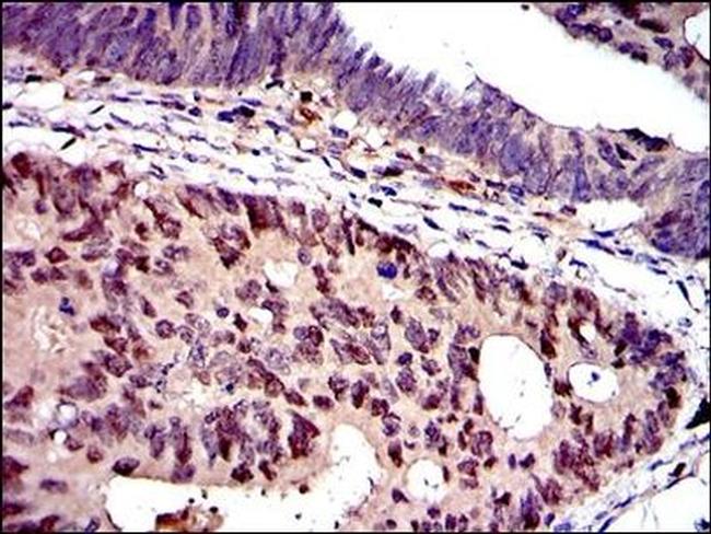 MCM2 Antibody in Immunohistochemistry (Paraffin) (IHC (P))