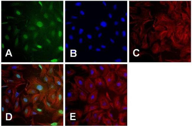 MDM2 Antibody in Immunocytochemistry (ICC/IF)