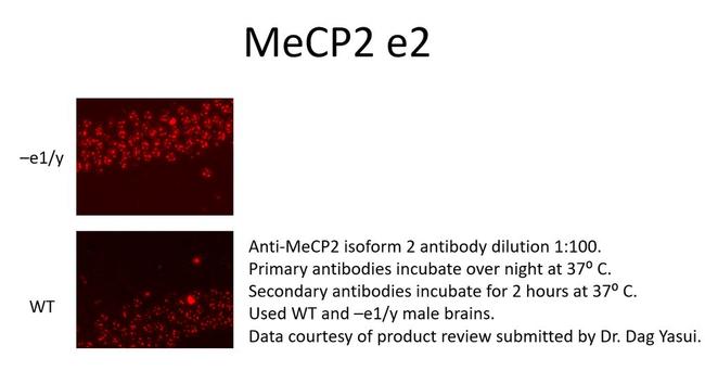 MeCP2 isoform 2 Antibody in Immunohistochemistry (IHC)