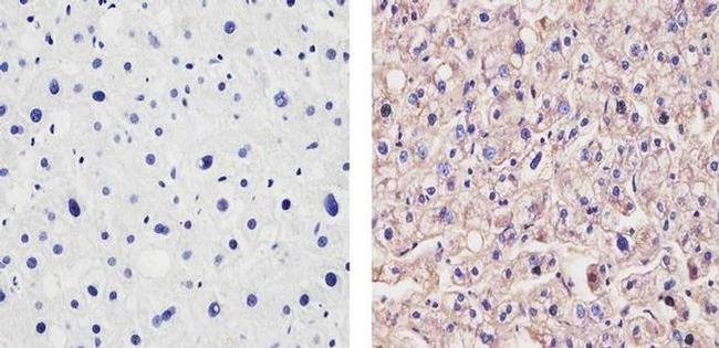 ApoA1 Antibody in Immunohistochemistry (Paraffin) (IHC (P))