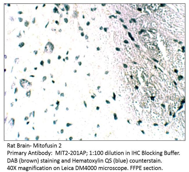 Mitofusin 2 Antibody in Immunohistochemistry (IHC)