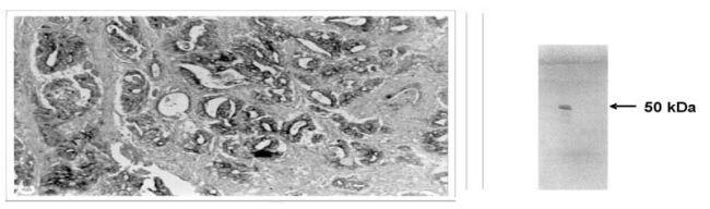 MMP3 Antibody in Immunohistochemistry (IHC)