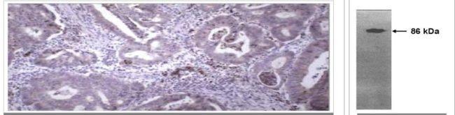 MMP9 Antibody in Immunohistochemistry (Paraffin) (IHC (P))