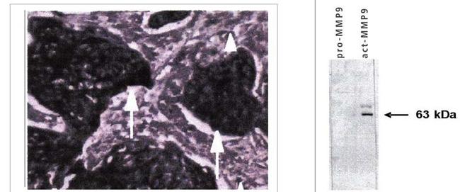 MMP9 Antibody in Immunohistochemistry (Paraffin) (IHC (P))