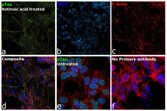 Phospho-Tau (Ser202, Thr205) Antibody in Immunocytochemistry (ICC/IF)