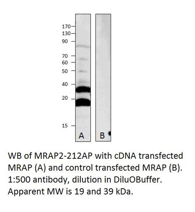 MRAP2 Antibody in Western Blot (WB)