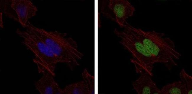 MSH6 Antibody in Immunocytochemistry (ICC/IF)