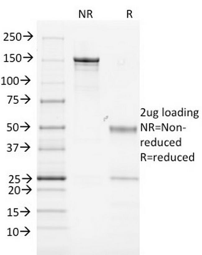 MHC II Antibody in SDS-PAGE (SDS-PAGE)