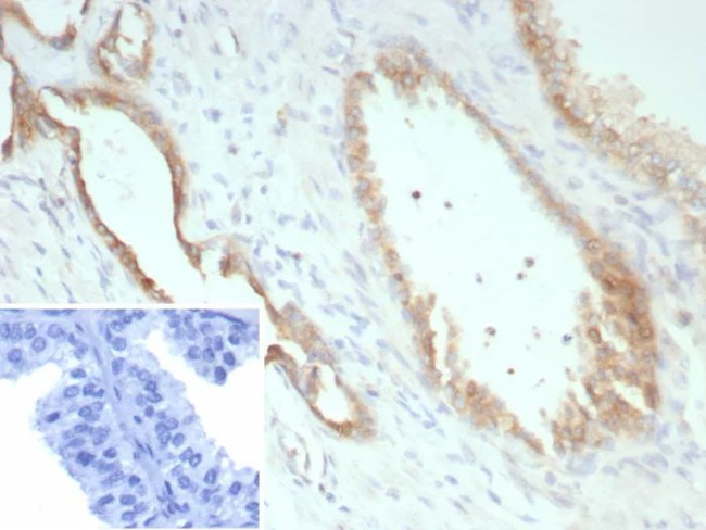 Pan-Cadherin Antibody in Immunohistochemistry (Paraffin) (IHC (P))