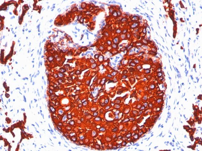 Cytokeratin, pan Antibody in Immunohistochemistry (Paraffin) (IHC (P))