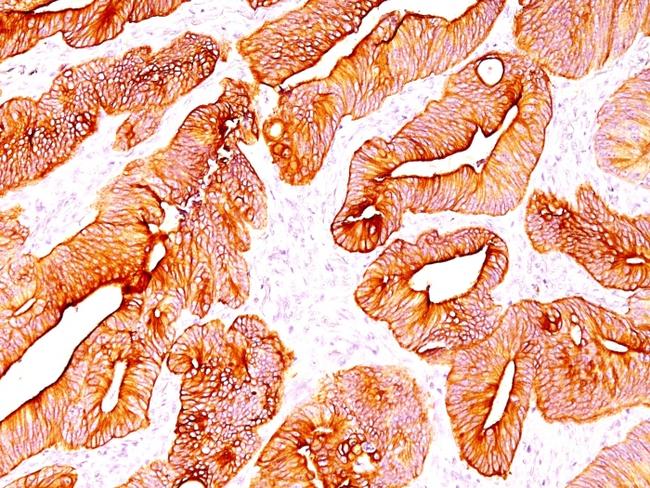 Cytokeratin, Multi Antibody in Immunohistochemistry (Paraffin) (IHC (P))