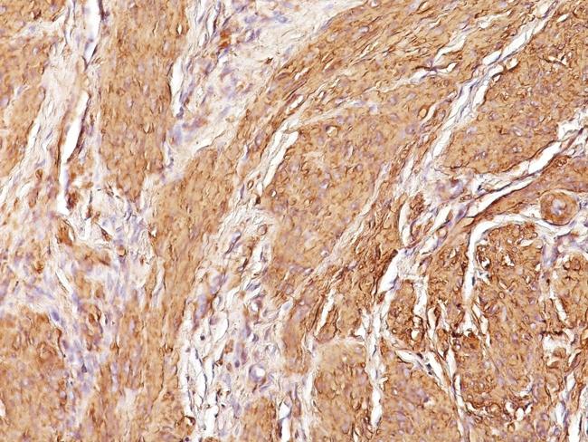 Actin, Muscle Specific (Muscle Cell Marker) Antibody in Immunohistochemistry (Paraffin) (IHC (P))