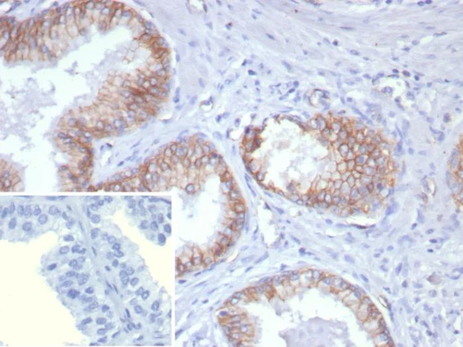 Pan-Cadherin Antibody in Immunohistochemistry (Paraffin) (IHC (P))