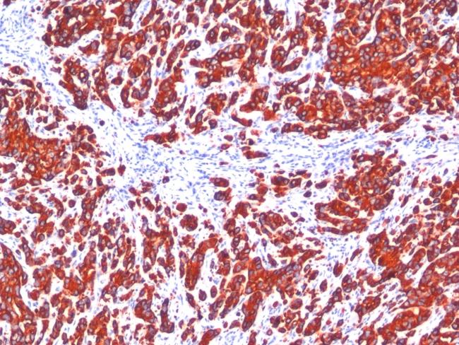 Cytokeratin, pan (Epithelial Marker) Antibody in Immunohistochemistry (Paraffin) (IHC (P))