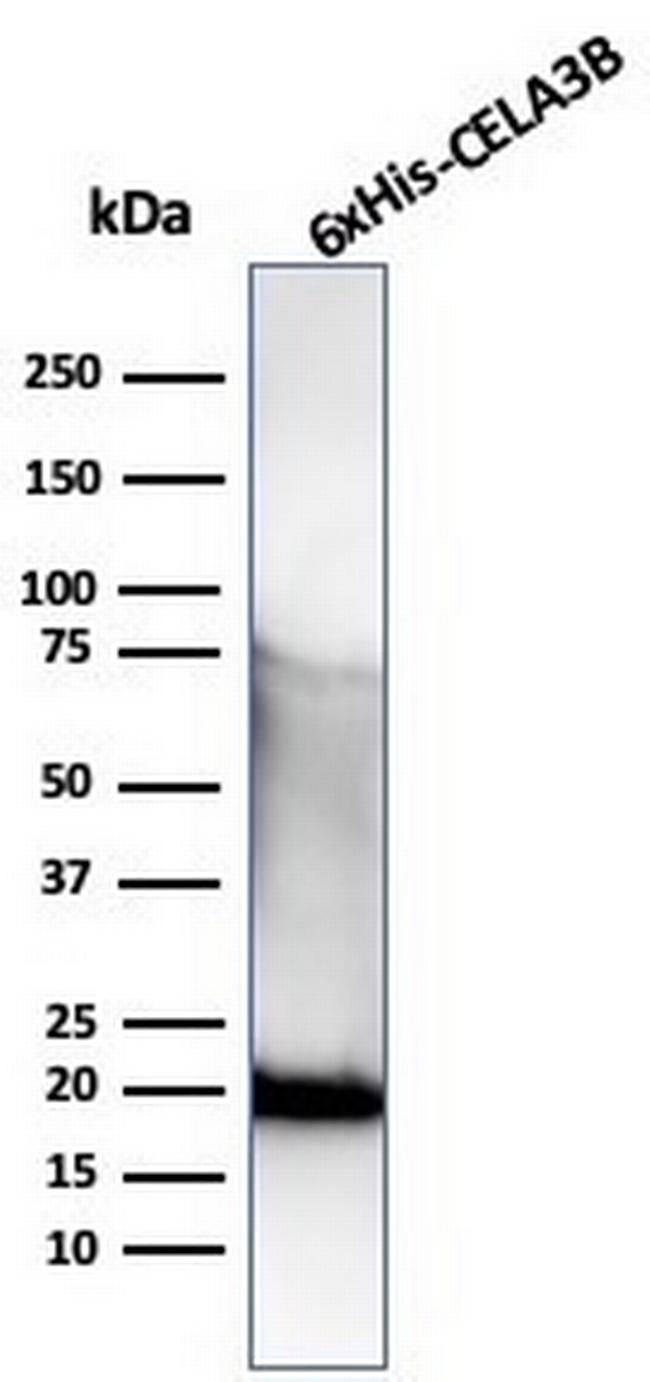 Hexa-histidine (Epitope Tag) Antibody in Western Blot (WB)