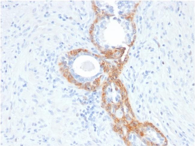 Cytokeratin, Basic (Type II or HMW) Antibody in Immunohistochemistry (Paraffin) (IHC (P))