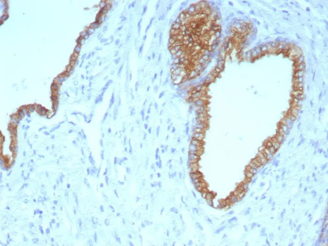 Cytokeratin 5/6 (Basal, Myoepithelial and Mesothelial Cell Marker) Antibody in Immunohistochemistry (Paraffin) (IHC (P))