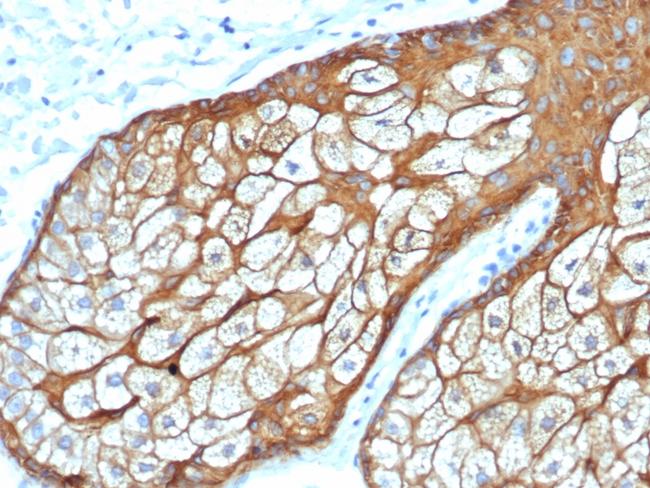 Cytokeratin, Type II (Epithelial Marker) Antibody in Immunohistochemistry (Paraffin) (IHC (P))