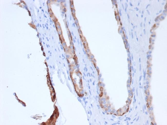 Cytokeratin, pan (Epithelial Marker) Antibody in Immunohistochemistry (Paraffin) (IHC (P))