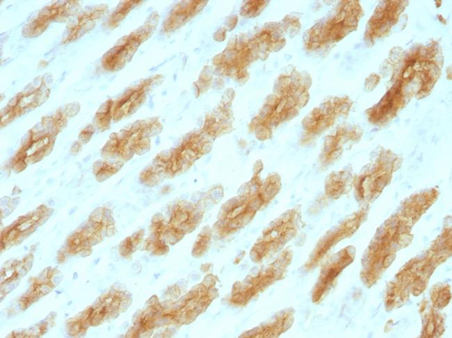 Cytokeratin, Basic (Type II or HMW) Antibody in Immunohistochemistry (Paraffin) (IHC (P))