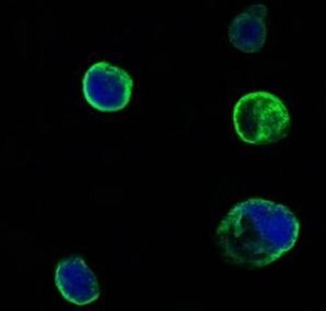 MUSK Antibody in Immunocytochemistry (ICC/IF)