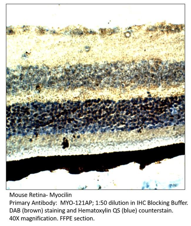 Myocilin Antibody in Immunohistochemistry (IHC)