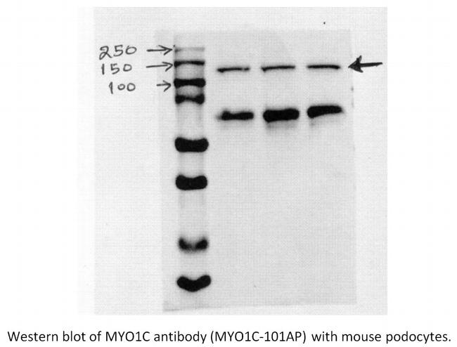 Myosin 1C Antibody in Western Blot (WB)