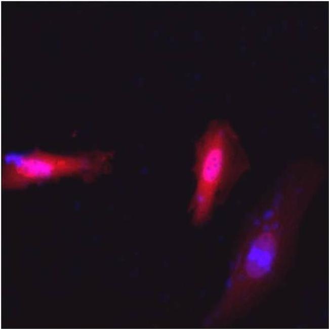 c-Myc Antibody in Immunocytochemistry (ICC/IF)