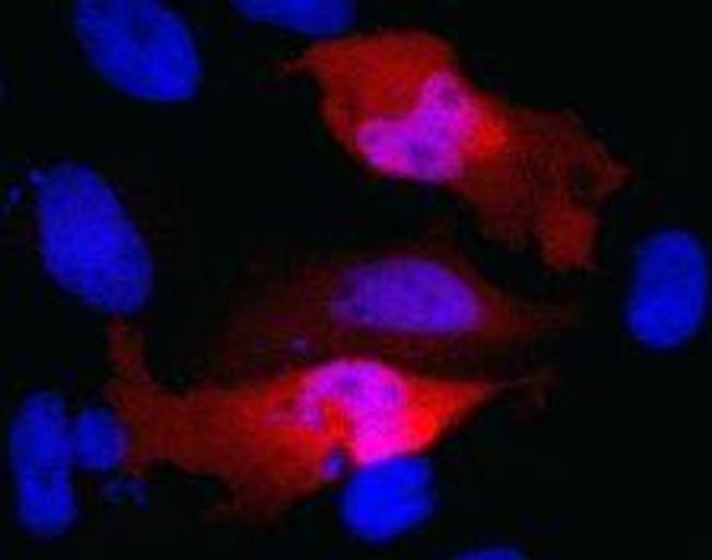 Myc Tag Antibody in Immunocytochemistry (ICC/IF)