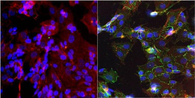 N-cadherin Antibody in Immunocytochemistry (ICC/IF)