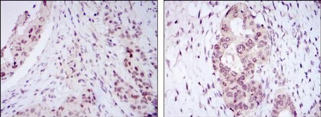 NAC1 Antibody in Immunohistochemistry (Paraffin) (IHC (P))