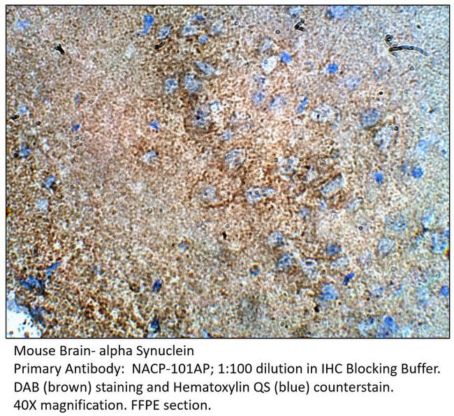 Alpha Synuclein Antibody in Immunohistochemistry (IHC)